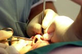 Mental health concerns rise with cosmetic surgery boom
