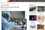 <Top N> China: Rescue hero may lose both legs