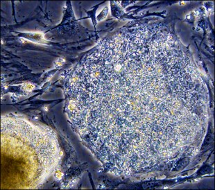 Shown above is a human stem cell before differentiation. A Korea medical team used stem cells to improve the conditions of patients suffering general paralysis in the latest achievement of the country’s stem cell therapy research.