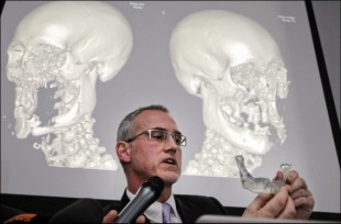 Professor Blondeel explains the facial transplantation process at a press conference. (Photo: De Standaard homepage)